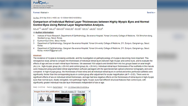 [Paper] EYEREUM published International SCI paper about High Myopia