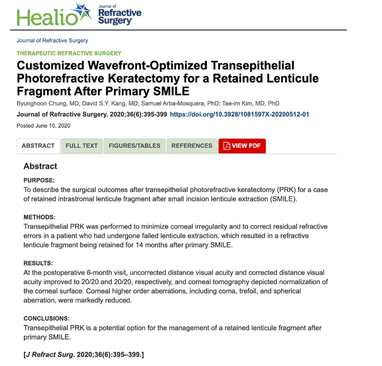 [Paper]Customized Wavefront-Optimized Transepithelial Photorefractive Keratectomy for a Retained Lenticule Fragment After Primary SMILE