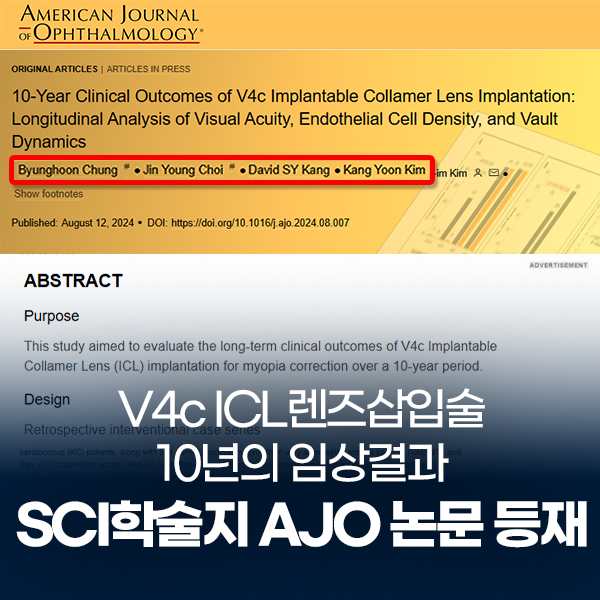 V4c ICL 렌즈삽입술의 10년 임상 결과 논문 SCI 안과학술지 AJO 등재 