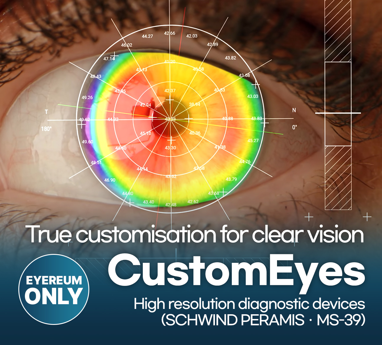 customeyes