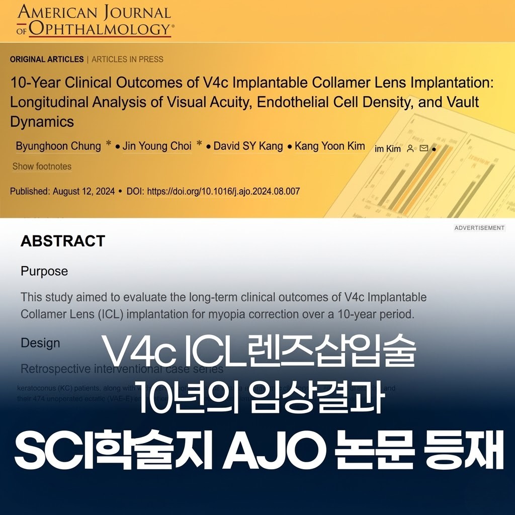V4c ICL 렌즈삽입술의 10년 임상 결과 논문 SCI 안과학술지 AJO 등재 