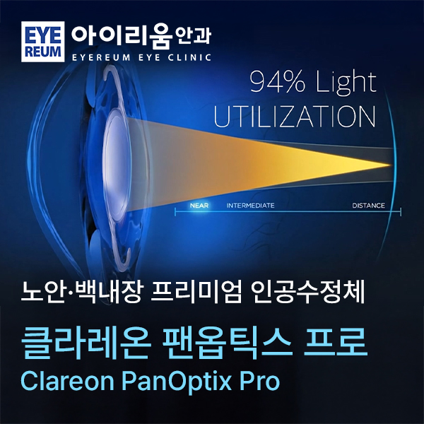 클라레온 팬옵틱스 프로, 첫 도입! 아이리움안과 NEW 노안백내장 다초점렌즈