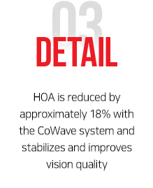HOA is reduced by approximately 18% with the CoWave system and stabilizes and improves vision quality