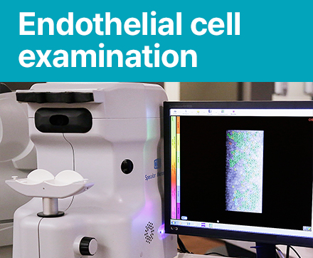 Endothelial cell examination