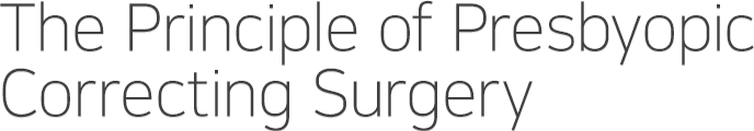 The Principle of Presbyopic Correcting Surgery