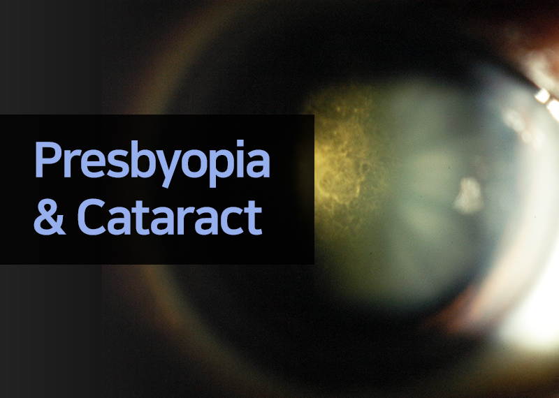 Presbyopia & Cataract